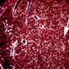 anapath.