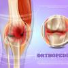 orthopédie