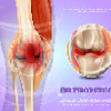 orthopédie